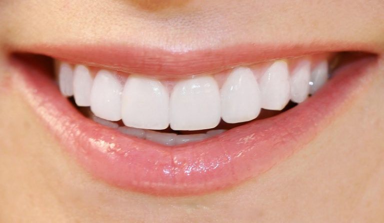 Porcelain Veneers For A Perfect Smile - Healthy B Daily