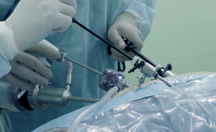 Laparoscopy: What Do You Need To Know? | Healthy B Daily