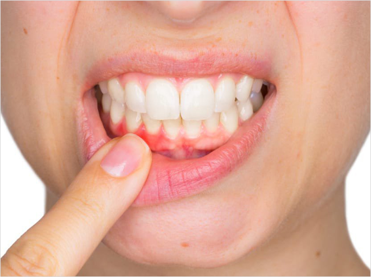 6-best-ways-to-deal-with-periodontal-disease-healthy-b-daily