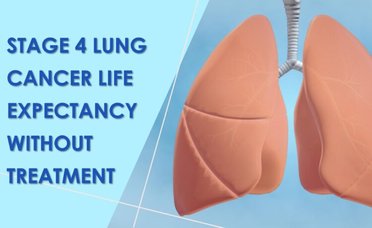 stage-4-lung-cancer-life-expectancy-without-treatment-healthy-b-daily